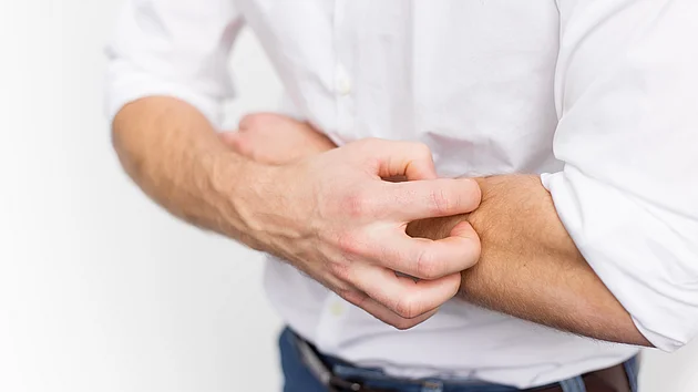 Starker Juckreiz Prurigo Nodularis bei jungen Mann