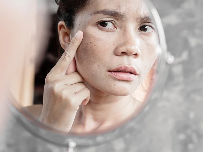 Psyche Mentale Gesundheit Hautkrankheiten