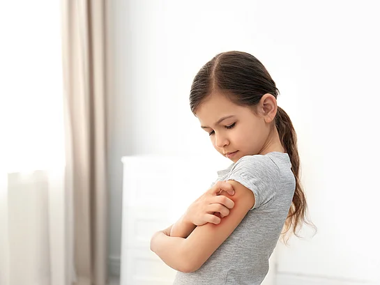 Kind Atopische Dermatitis Neurodermitis Juckreiz