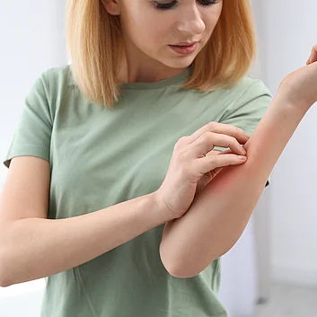 Juckreiz Neurodermitis