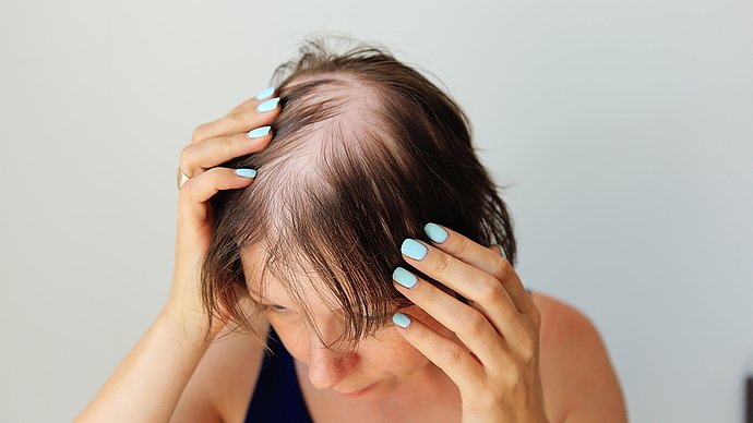Haarausfall dünnes Haar
