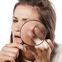 Altersakne acne tarda Pickel