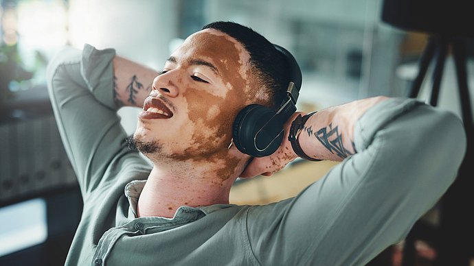 Vitiligo Weißfleckenkrankheit bei jungem Mann