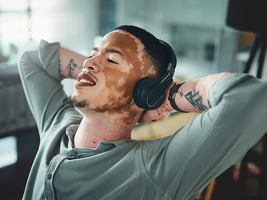 Vitiligo Weißfleckenkrankheit bei jungem Mann