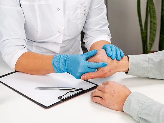 Dermatologe untersucht Patient mit Schuppenflechte Psoriasis