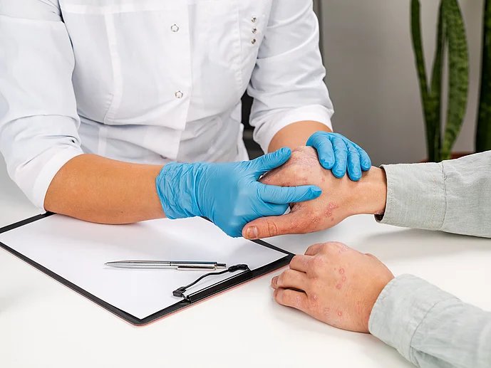 Dermatologe untersucht Patient mit Schuppenflechte Psoriasis