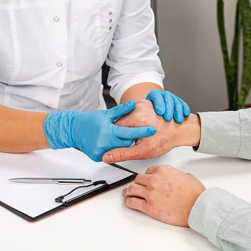 Dermatologe untersucht Patient mit Schuppenflechte Psoriasis