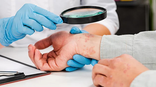 Hautkrankheiten Dermatologe Hautarzt