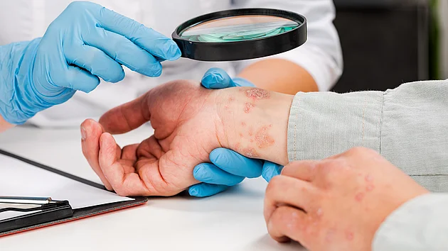 Hautkrankheiten Dermatologe Hautarzt