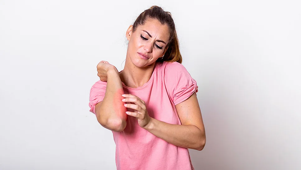 Juckreiz Neurodermitis Atopische Dermatitis junge Frau