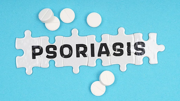 Psoriasis Schuppenflechte Behandlung