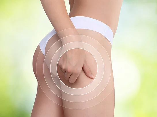 Cellulite Orangenhaut Tipps für schönere Haut