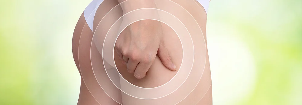 Cellulite Orangenhaut Tipps für schönere Haut