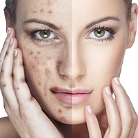 hautinfo