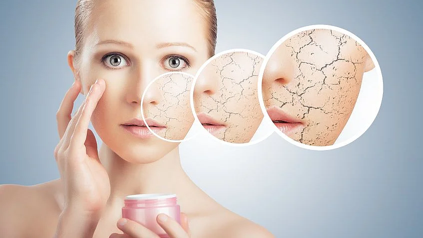 trockene Haut schuppige Gesichtshaut richtige Creme