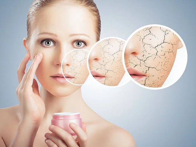 trockene Haut schuppige Gesichtshaut richtige Creme