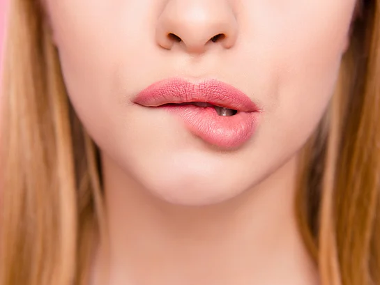 Fieberblase Herpes Lippe richtig behandeln
